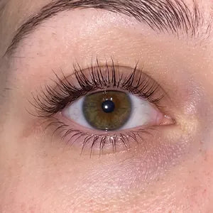 The same eye at week six
