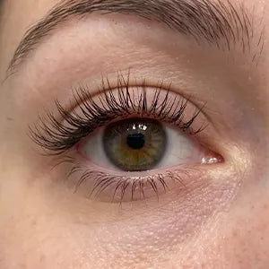 The same eye at week nine